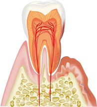 歯周病について